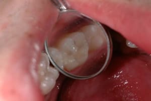 Dsc 2671 hkts8h - Eugenol