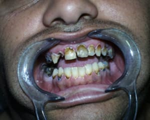 Dvd1 dis2ff - Eugenol