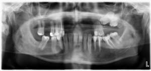 Efybrgfw3qxbcbzapjxs - Eugenol