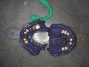Empr muqueuse dq13ja - Eugenol
