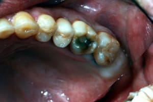 Essayage pwdis9 - Eugenol