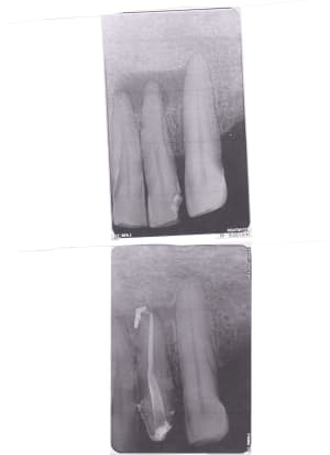 Eugenol sterildent220160421 pg2yql - Eugenol