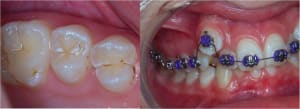 Exemple 2 nu1lzj - Eugenol