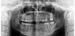 F9dslo1h6p30jy9hir9t7kha9wws - Eugenol