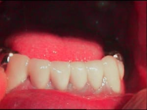 Face d5czzw - Eugenol