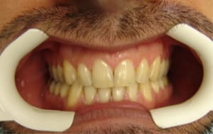 Face mhxoak - Eugenol