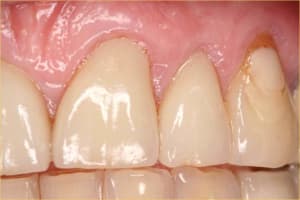 Facettttte msv4we - Eugenol