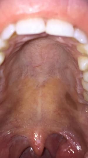 Fekzaeqoel90tjkvdxdn - Eugenol