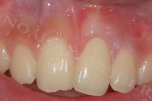 Final pvd225 - Eugenol