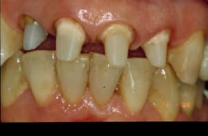 Finition osilec - Eugenol
