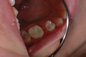 Finito hvo5lm - Eugenol