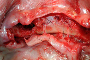 Fistulle double kkcxws - Eugenol
