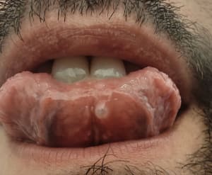 Folgq5j9tnh7iivtwp3jgcgn1nmc - Eugenol