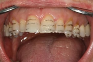 Fraisage   faire auwmdu - Eugenol