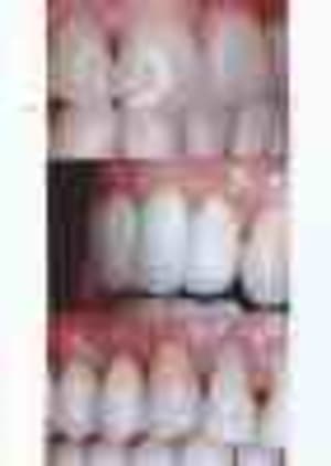 G5bewumtq6grgqkdlzvp - Eugenol