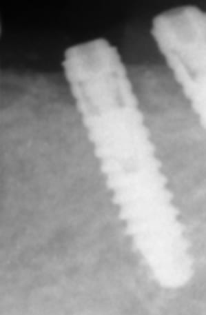 G60ezsp3olw6pn1txritccinckln - Eugenol