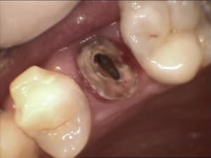Gar3 hmfm1f - Eugenol