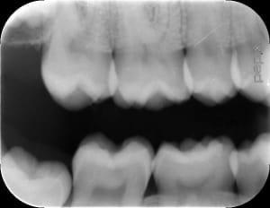 Gm585ugwk1le51pskczoendn0ucm - Eugenol