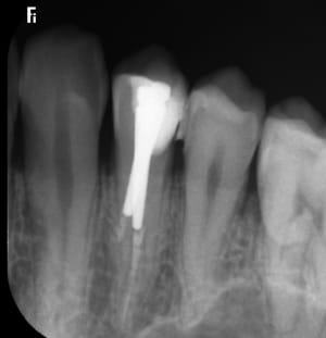 Gt3pwckvaflauwcwa8rwrw8xeb1i - Eugenol
