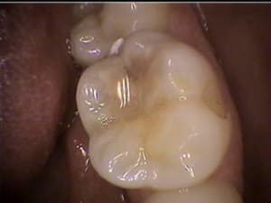 Gwi1 zhskbd - Eugenol