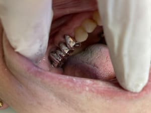 H5wv5lel25mxvkyb6akx - Eugenol