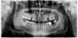 Hc6tn7nwfb35vabhqzbe - Eugenol