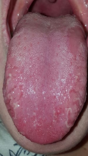 Hjfvw7nnfknn5x5voneo - Eugenol