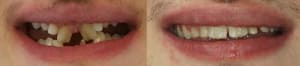 I2ix89tgtz7qpddnb5uzs57ooi6e - Eugenol