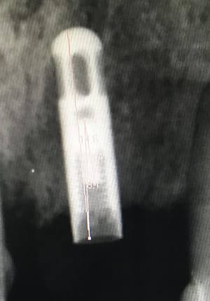 I8tw4sis61nv7bubnvzt - Eugenol