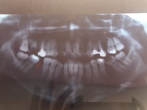 Il3q5jtbm7asqvndqs3w - Eugenol