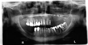 Image0 1 td4vgf - Eugenol