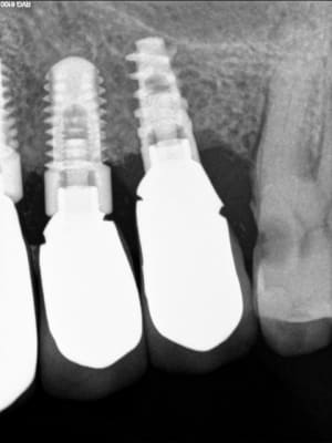 Image004 k6vzdc - Eugenol