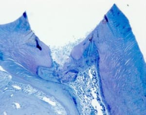 Imageal hyfigo - Eugenol