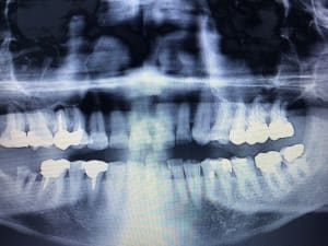 Image ju0vzp - Eugenol