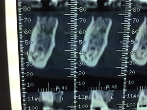 Image urdy8a - Eugenol