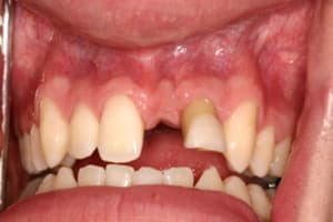 Img 7560 nq7lhw - Eugenol