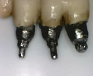 Implant biotech c4muvo - Eugenol
