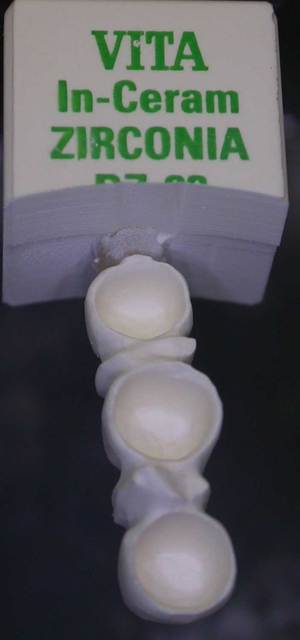 Implants krtqw1 - Eugenol