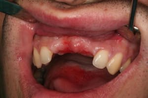 Initial frggui - Eugenol