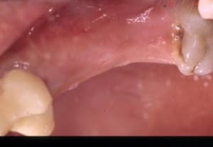 Initial rir4cj - Eugenol