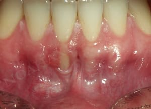 Initial t897lc - Eugenol