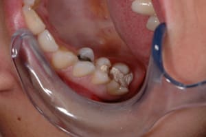 Initial z2qect - Eugenol