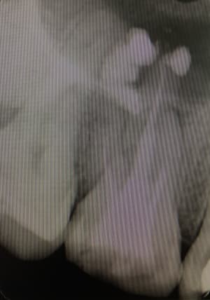 Iras6oiwu7jgfjehfqr6 - Eugenol