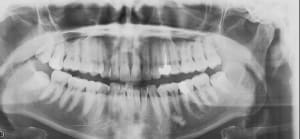 Jc2 rsg4wn - Eugenol