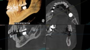 Jelt4ysd7n7i5km47a8di879otij - Eugenol