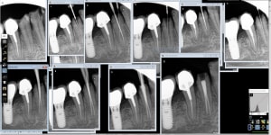 Jnulth0f9xux31tyok12gyfmt9tx - Eugenol
