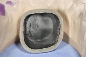 Joint ceram  3  emvitb - Eugenol