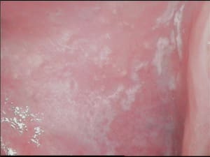 Joue fgxpeh - Eugenol