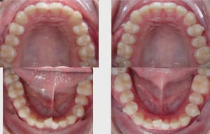 K4p8hejbl730cgznduj4ecbumnxg - Eugenol