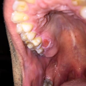 Kf7rcagdnlxknbp5bug4 - Eugenol